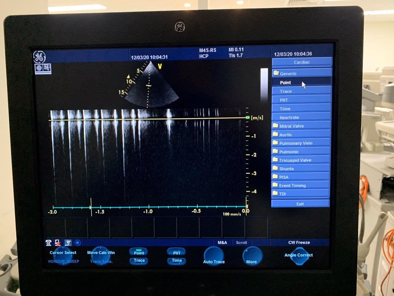 2008 GE Vivid S6 Cardiac, photo 7