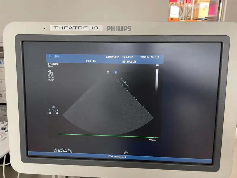 2010 Philips iE33 Cart G, photo 4