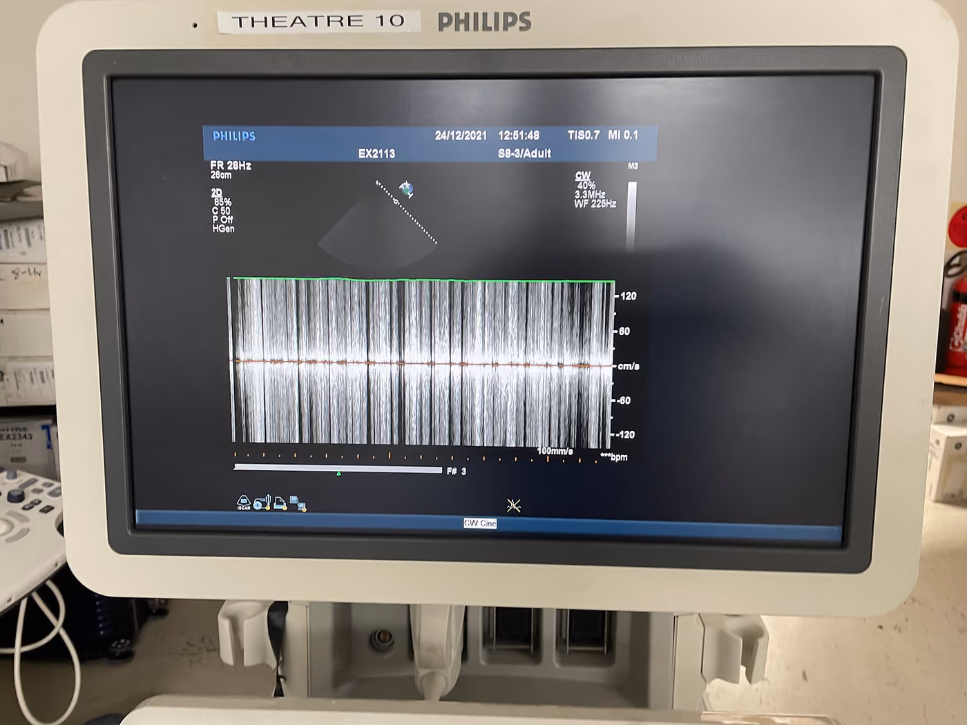 2010 Philips iE33 Cart G, photo 5