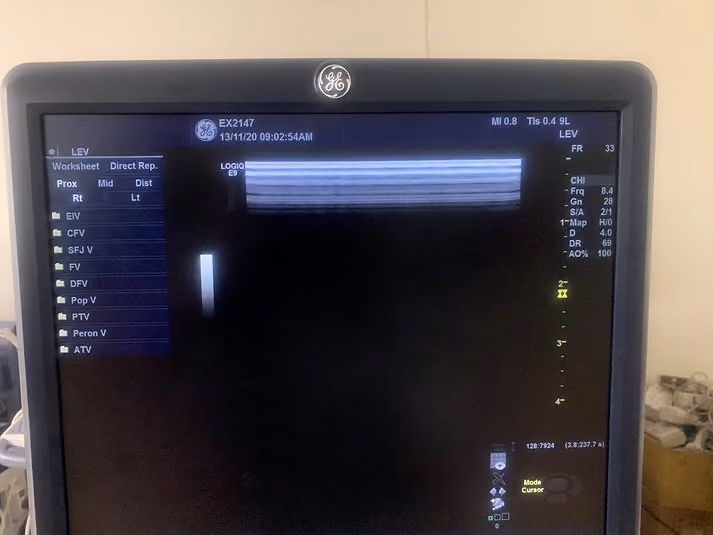 2013 GE Logiq E9, photo 6