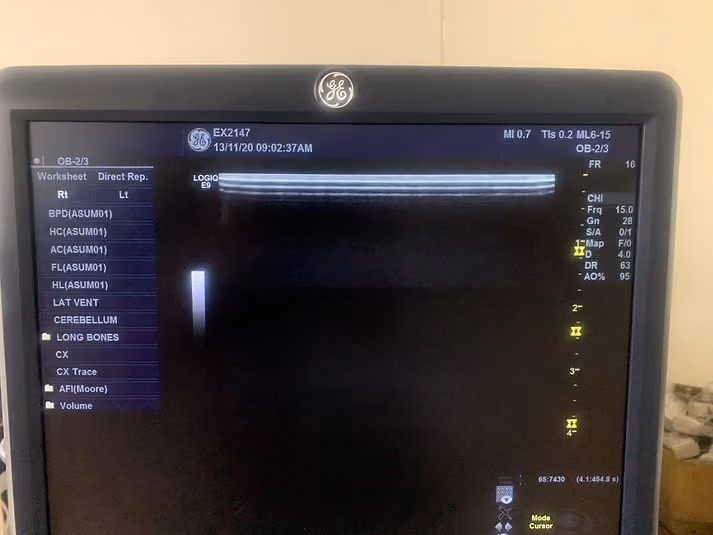 2013 GE Logiq E9, photo 8
