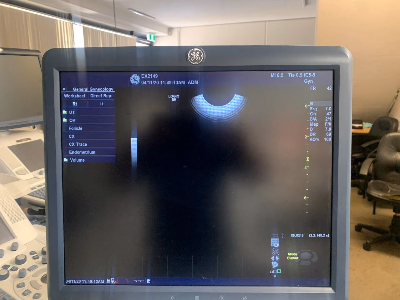 2015 GE Logiq E9, photo 5