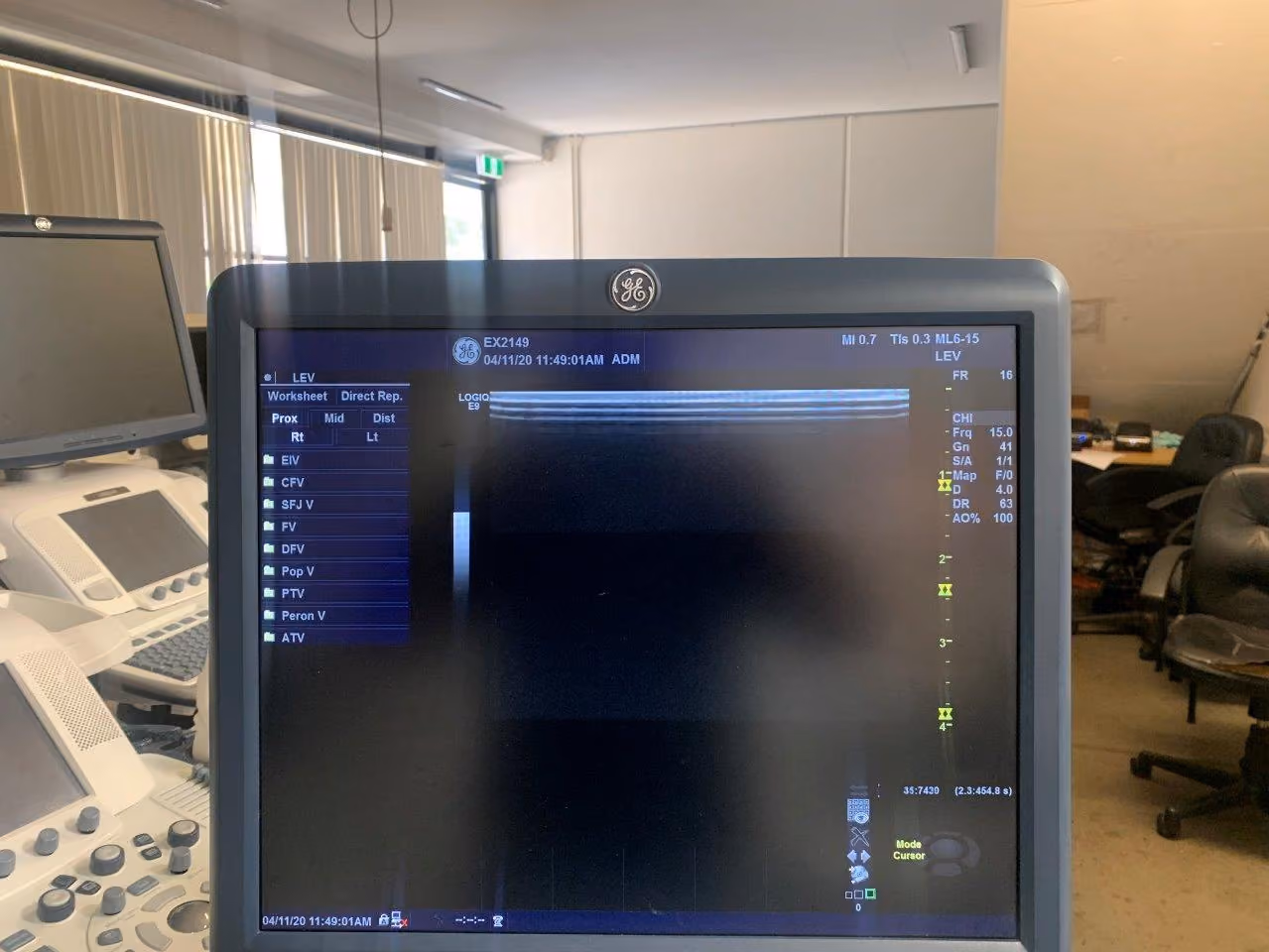 2015 GE Logiq E9, photo 6