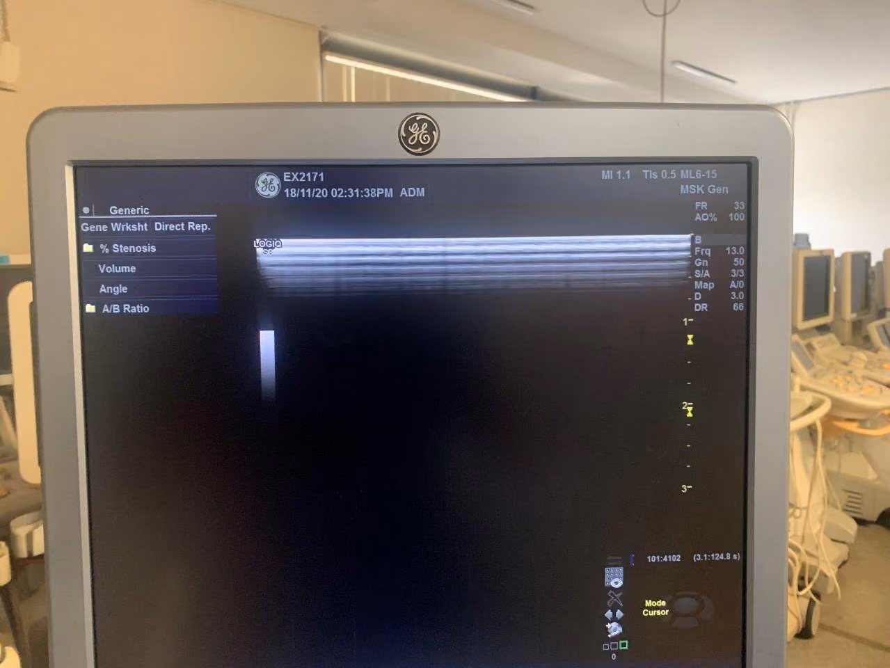 2013 GE Logiq S8, photo 6