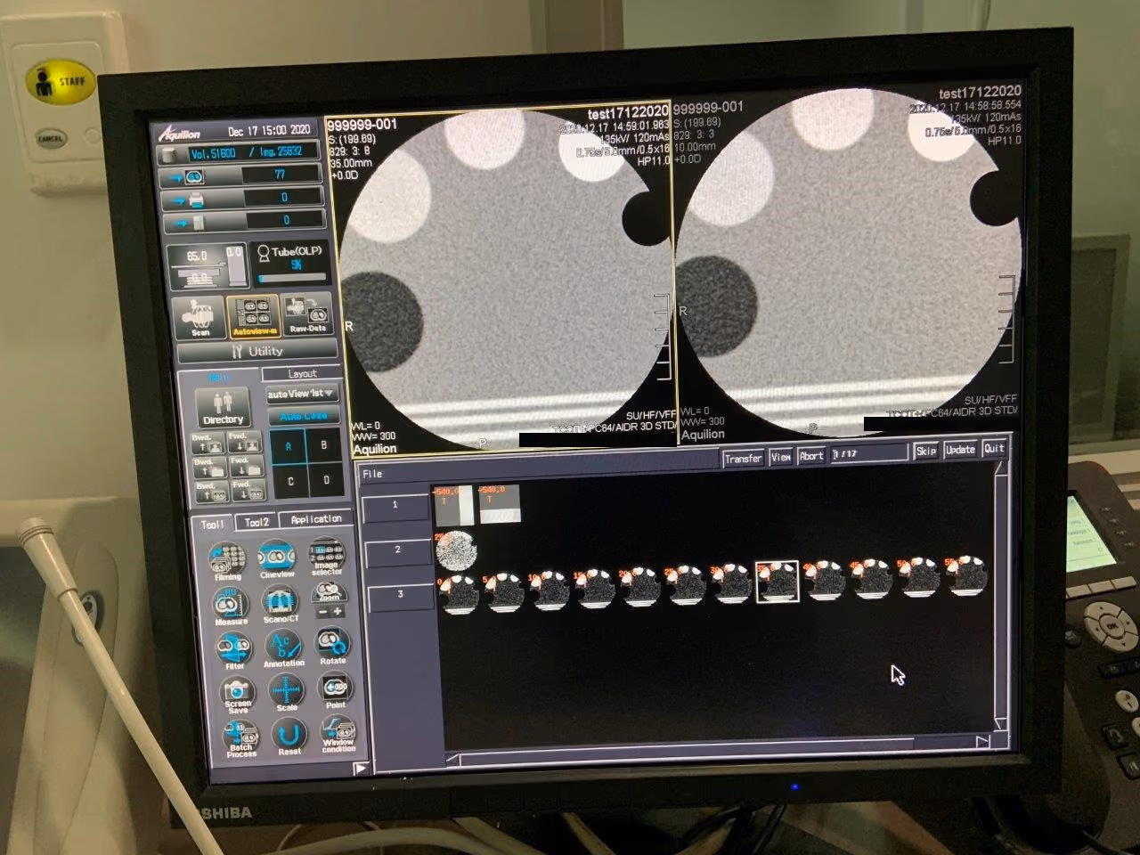 2010 Canon Aquilion RX, photo 8