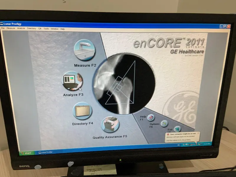 2008 GE Lunar Prodigy BMD, photo 2