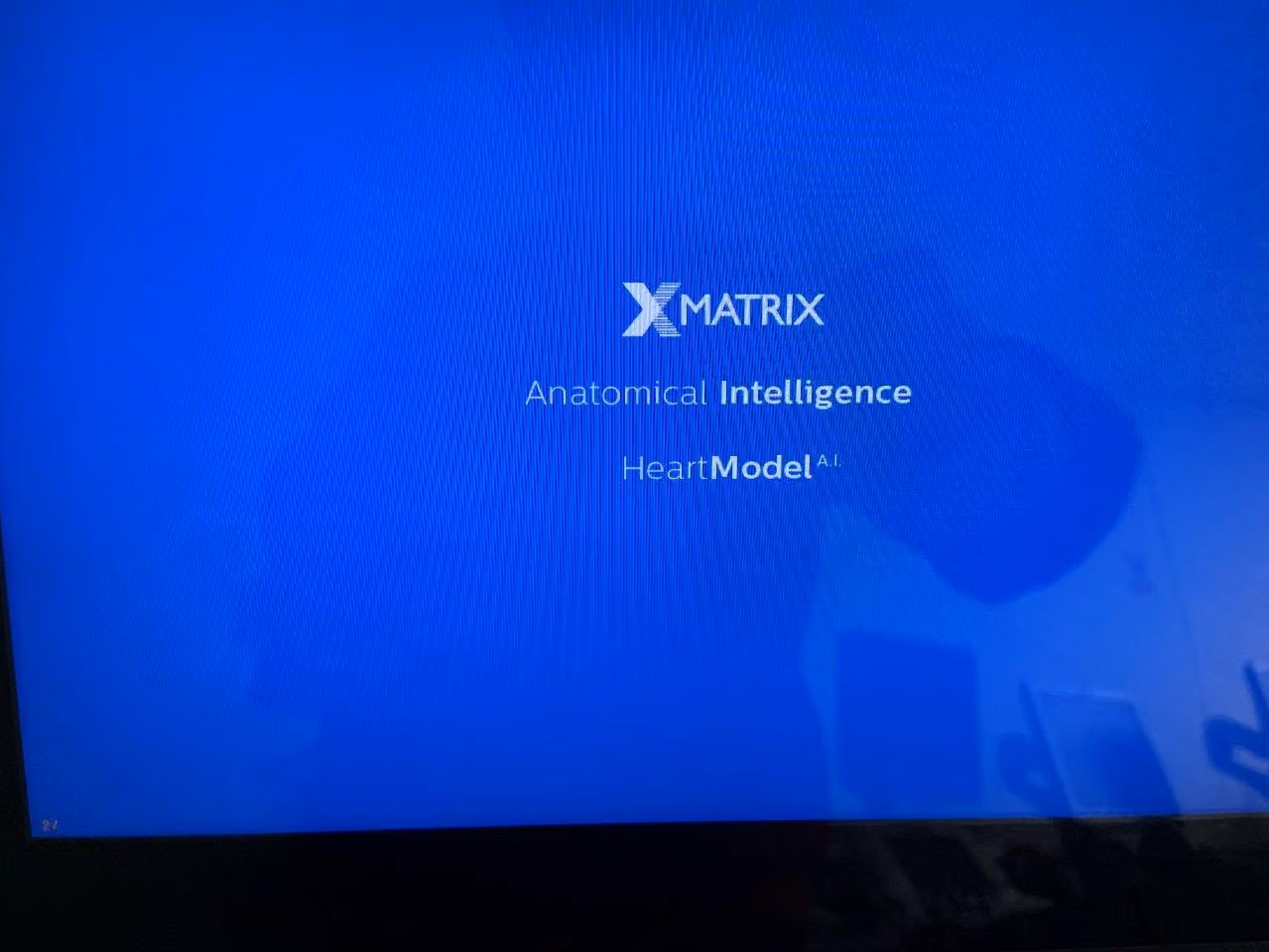 2019 Philips EPIQ CVx, photo 8