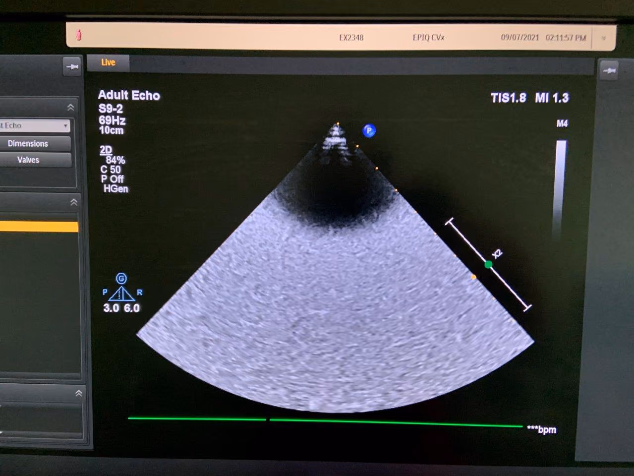 2019 Philips EPIQ CVx, photo 9