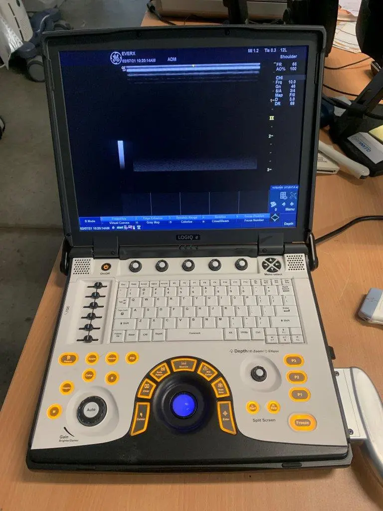 2015 GE Logiq e, photo 1