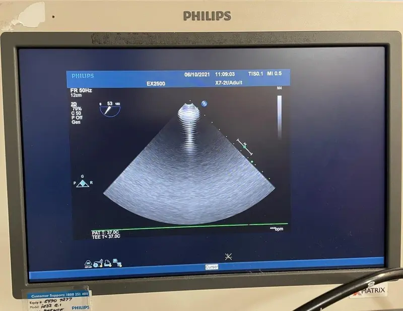 Philips X7-2t, photo 3
