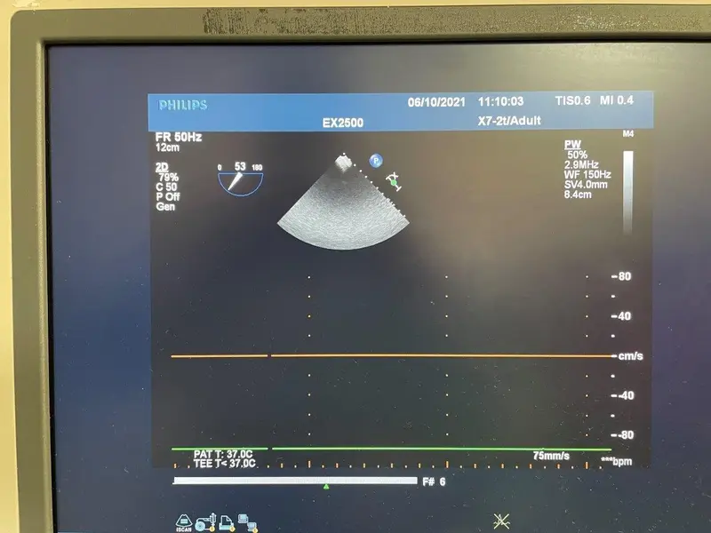 Philips X7-2t, photo 4
