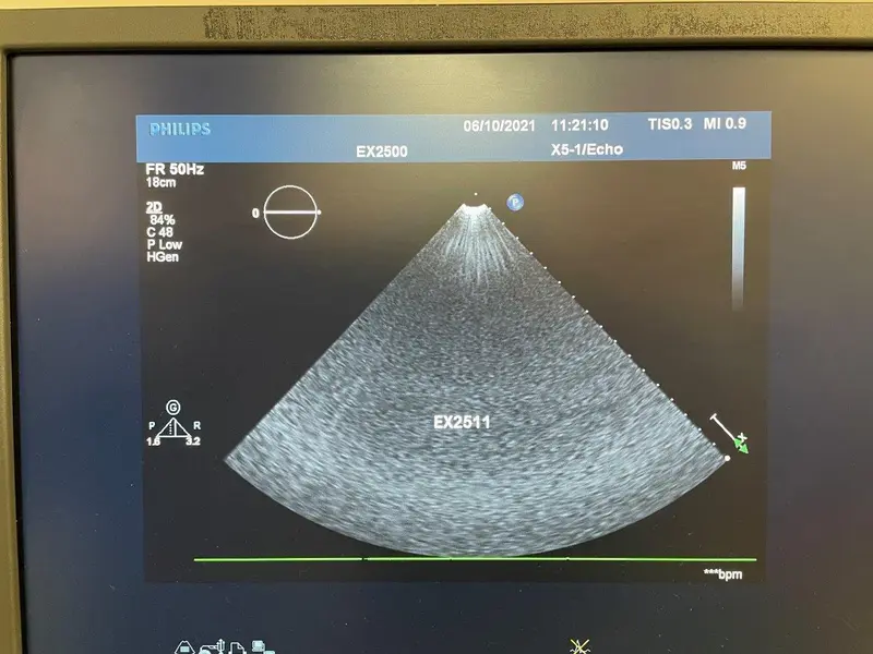 2000 Philips X5-1, photo 2