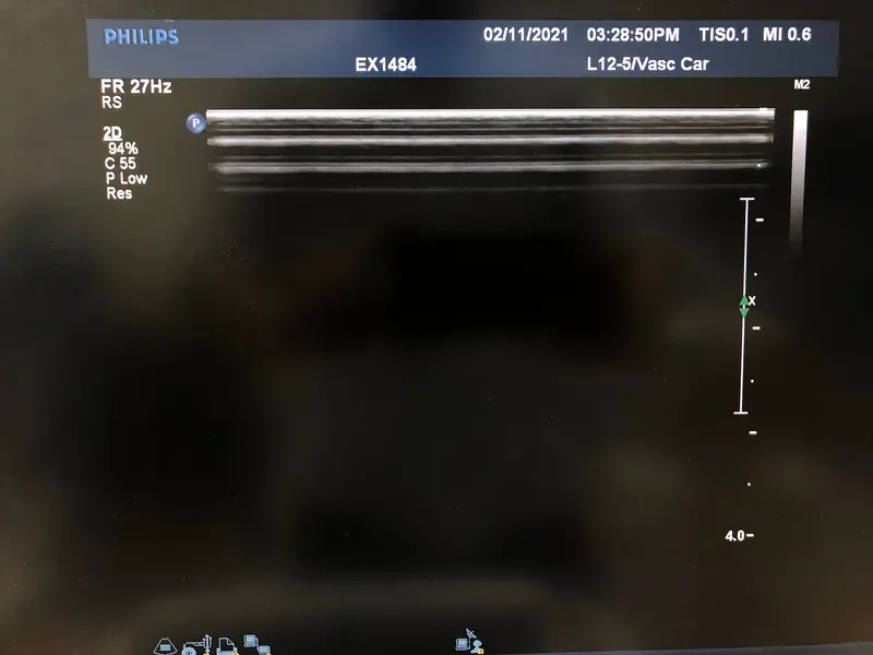 Philips L12-5, photo 2