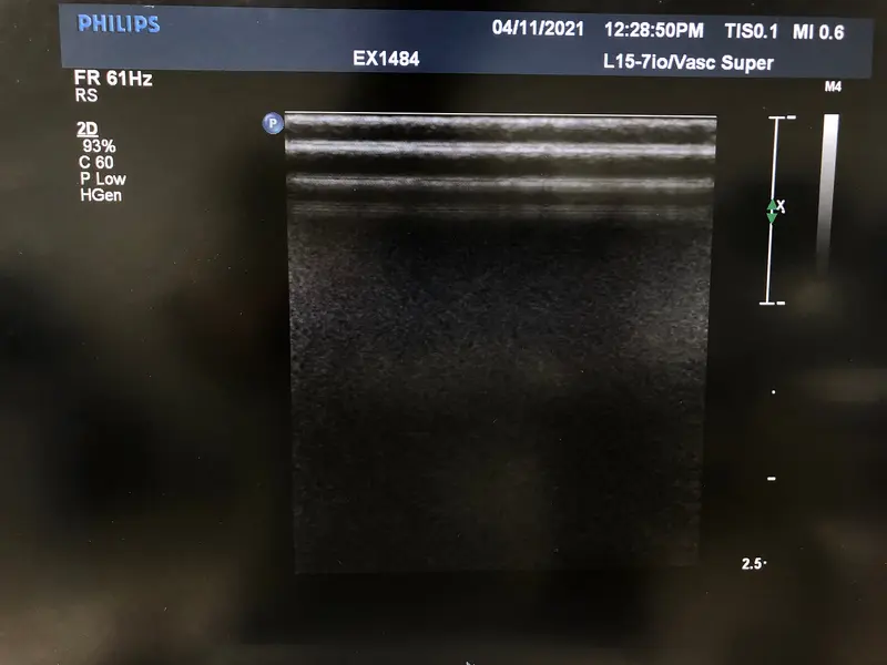 Philips L15-7io, photo 2