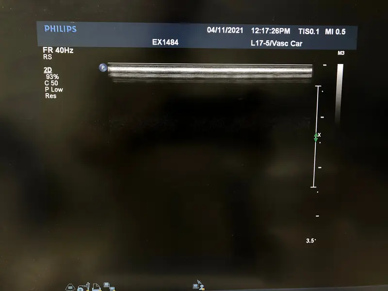 Philips L17-5, photo 2