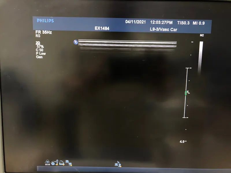 Philips L9-3, photo 2