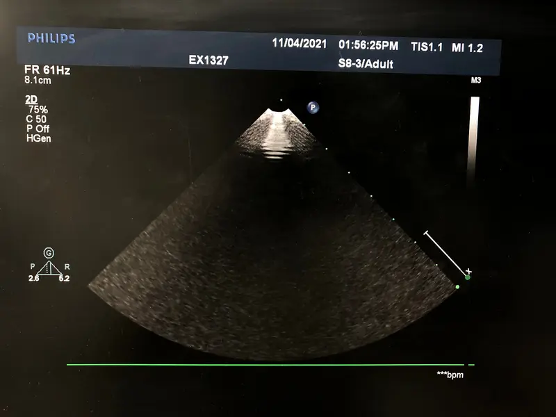 Philips S8-3, photo 2