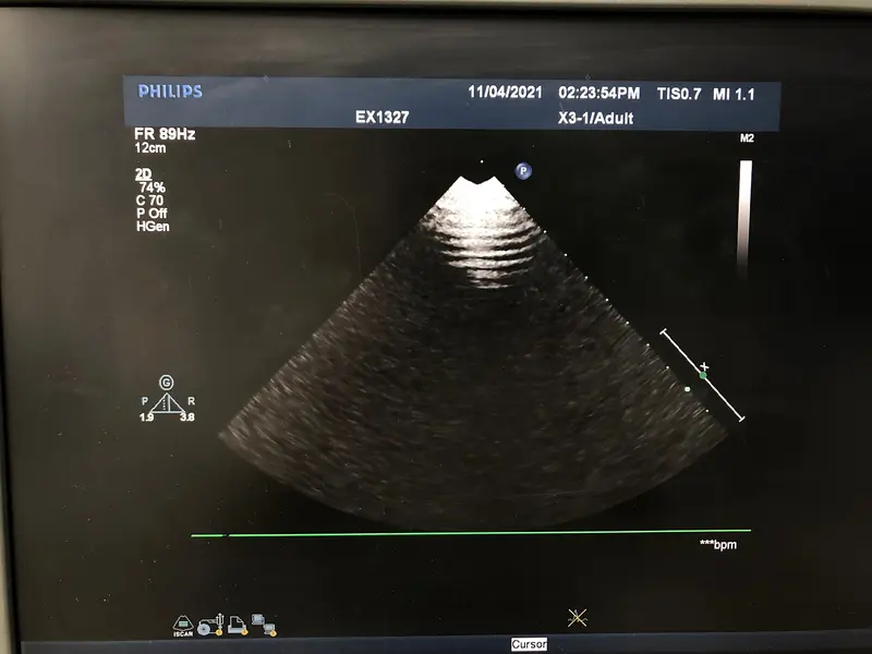 2000 Philips X3-1 Probe, photo 2