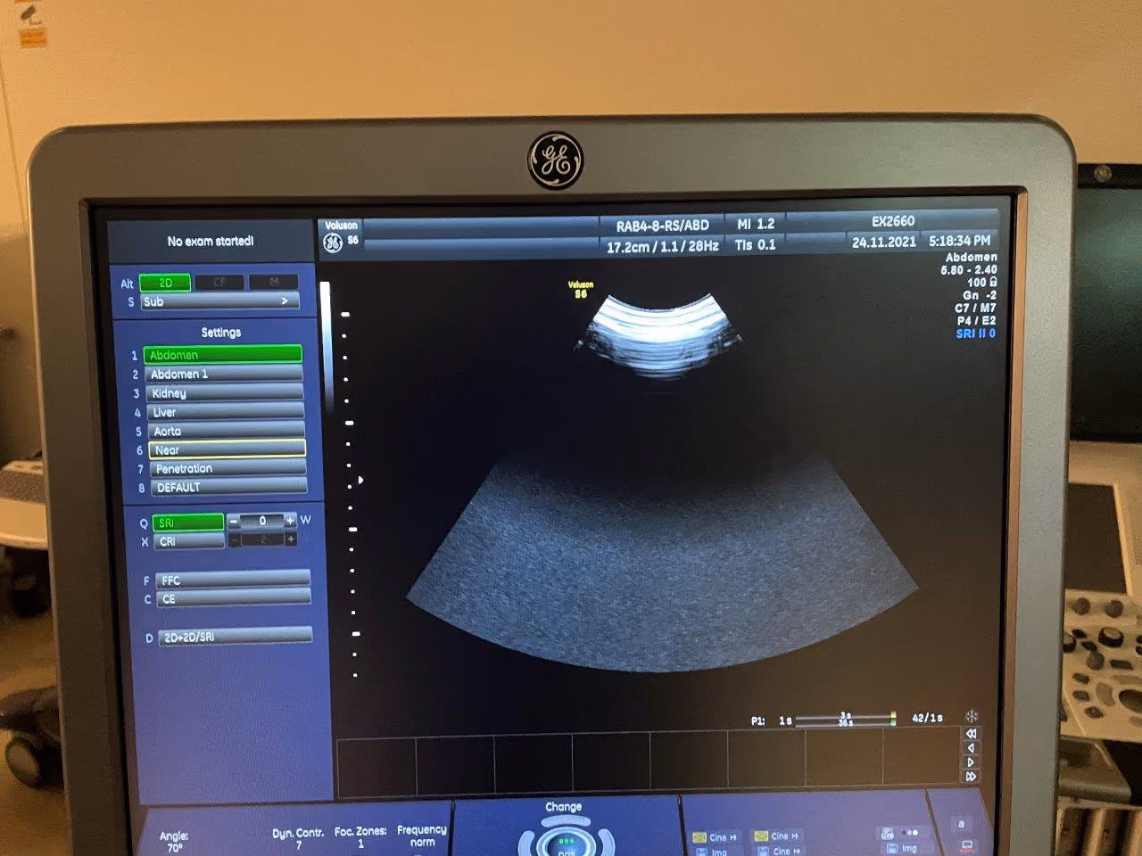 2011 GE Voluson S6 -3D/4D, photo 7