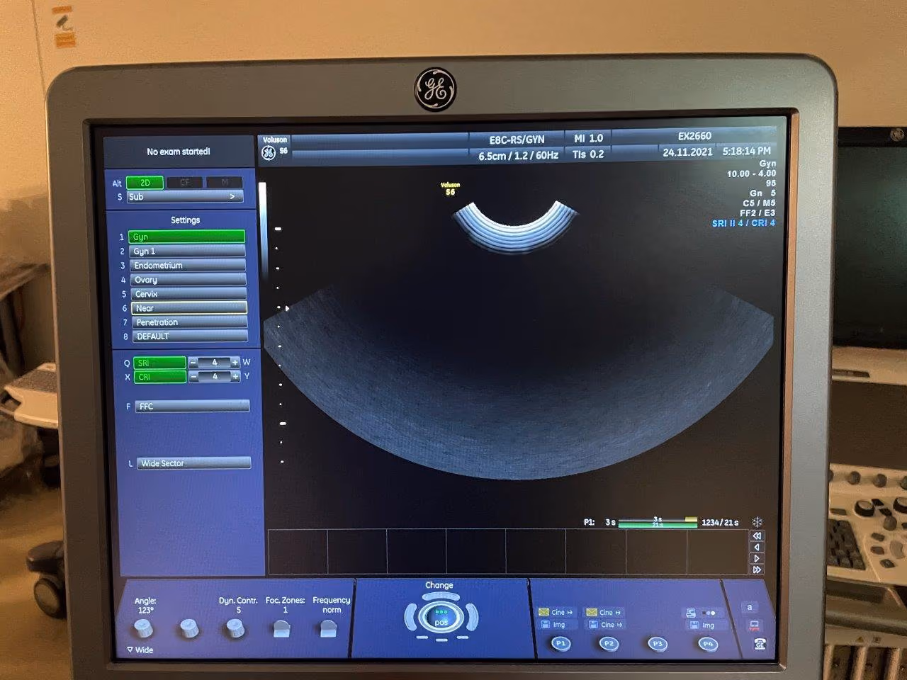 2011 GE Voluson S6 -3D/4D, photo 8
