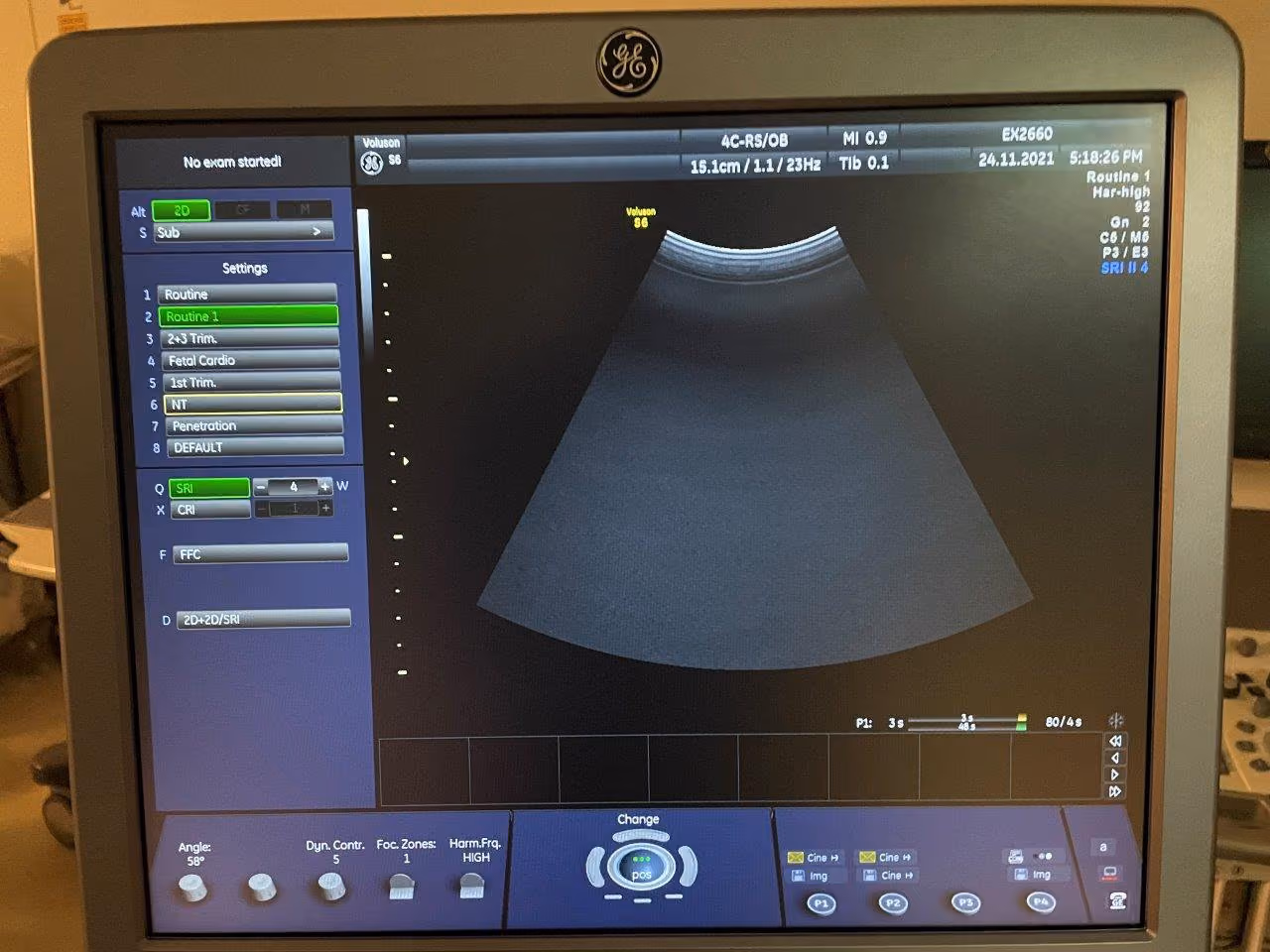 2011 GE Voluson S6 -3D/4D, photo 9