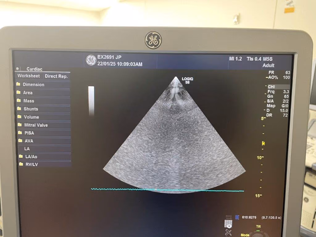 2013 GE Logiq S8, photo 5