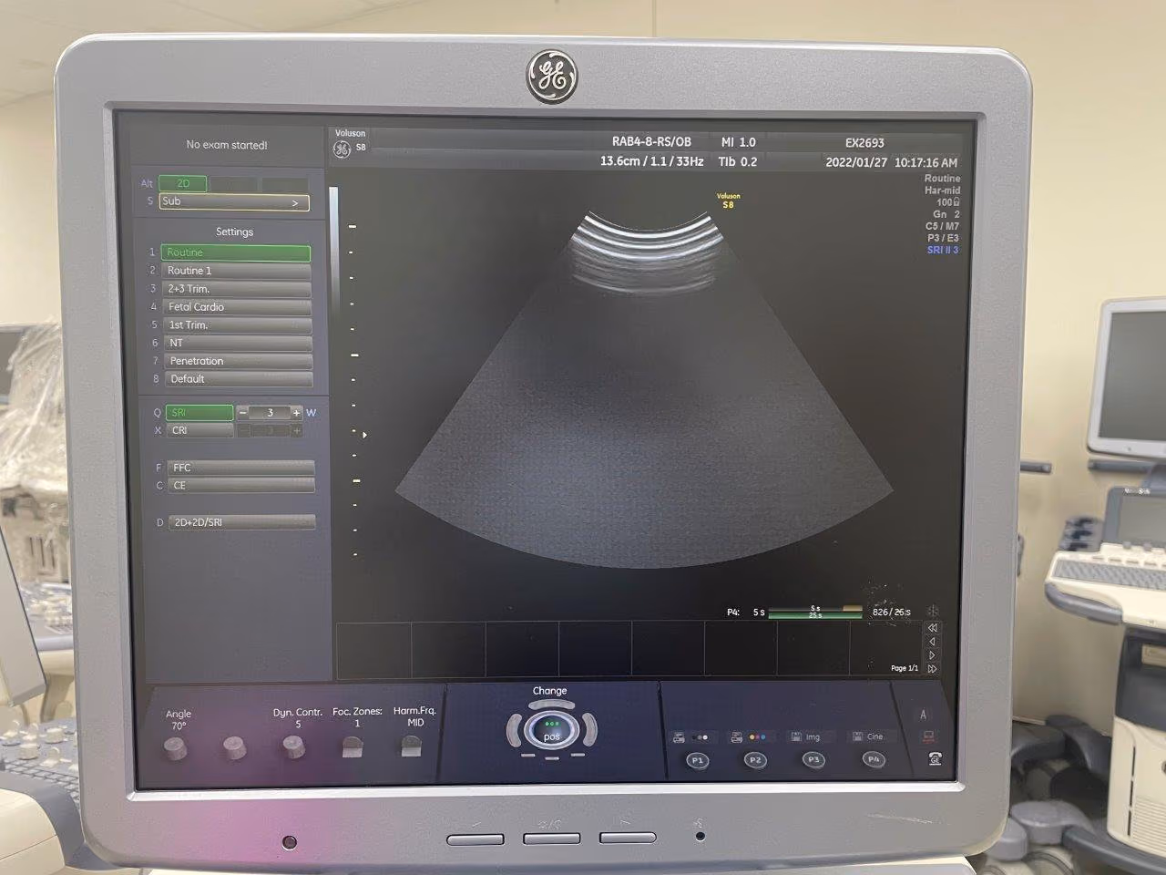 2012 GE Voluson S8 – 3D/4D, photo 6