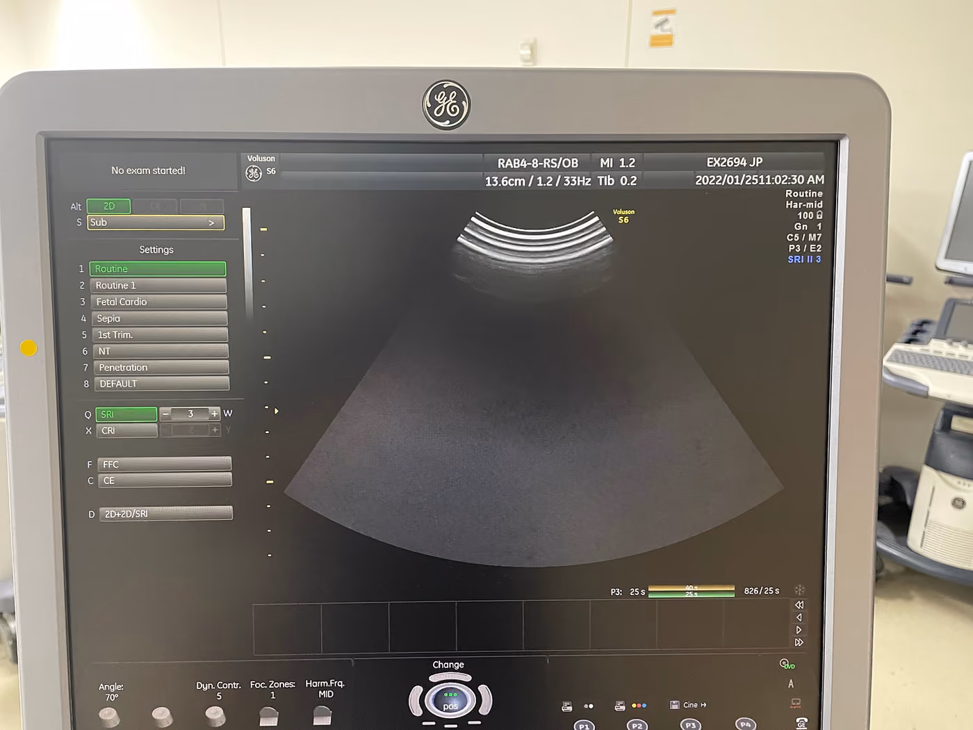 2011 GE Voluson S6 -3D/4D, photo 6
