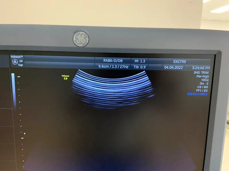 2013 GE Voluson E8 Expert, photo 4