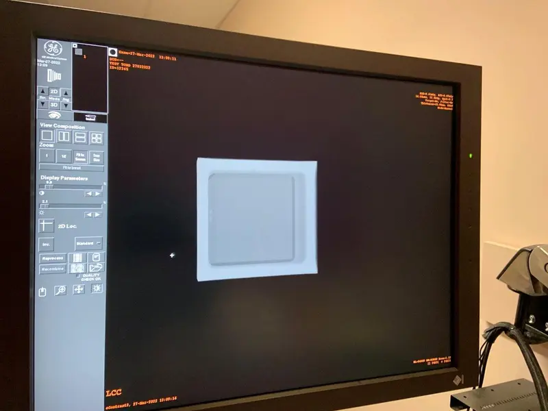 2010 GE Seno Essentials Mammography with Tomo, photo 4