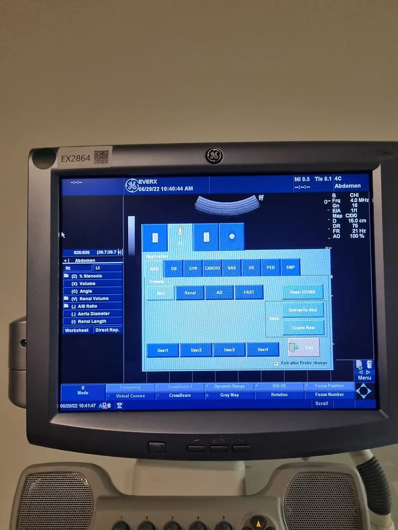 2012 GE Logiq P5, photo 4