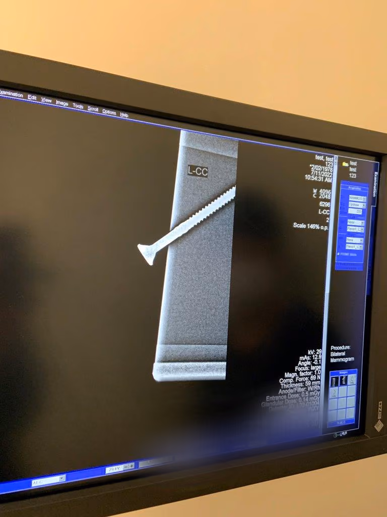 2014 Siemens Inspiration Digital Mammography, photo 8