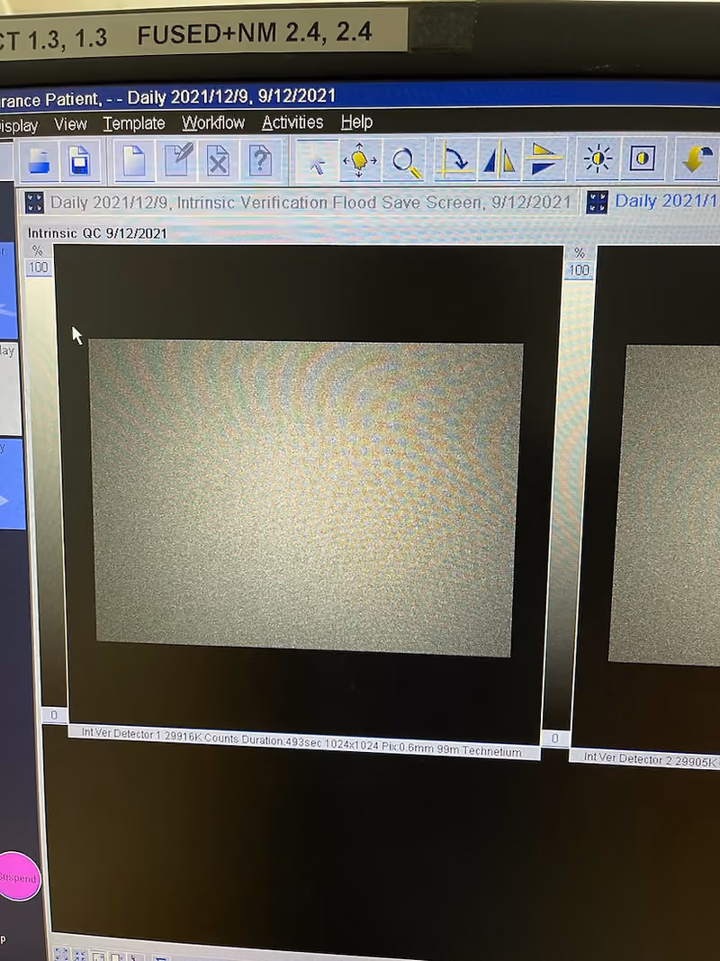 2010 Siemens Symbia T2 Spect Camera, photo 11