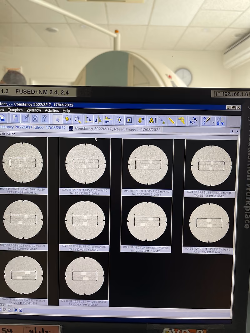 2010 Siemens Symbia T2 Spect Camera, photo 12
