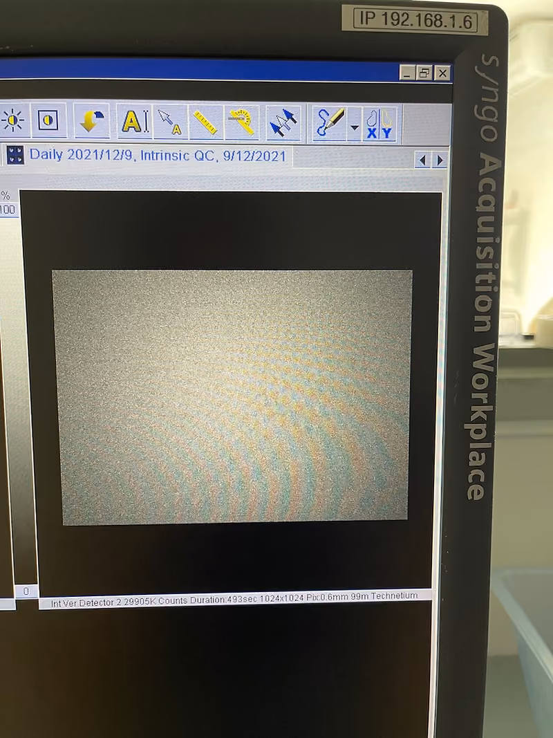 2010 Siemens Symbia T2 Spect Camera, photo 14