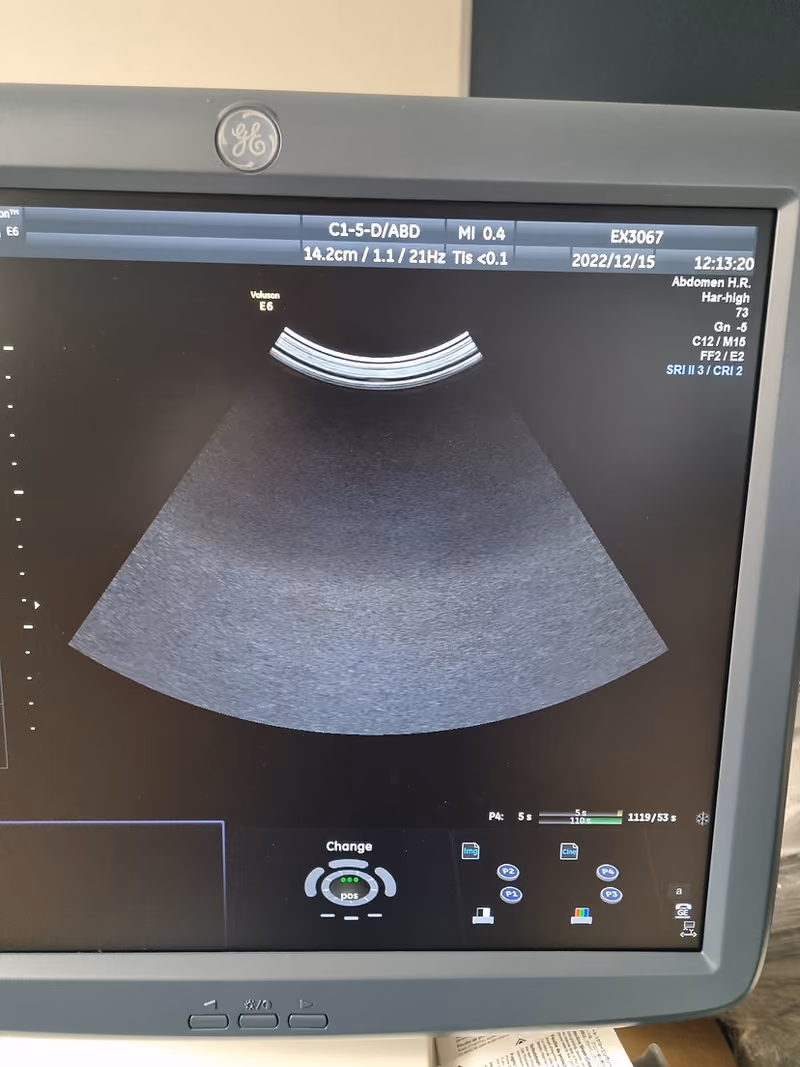 2015 GE Voluson E6 BT 13.5, photo 6