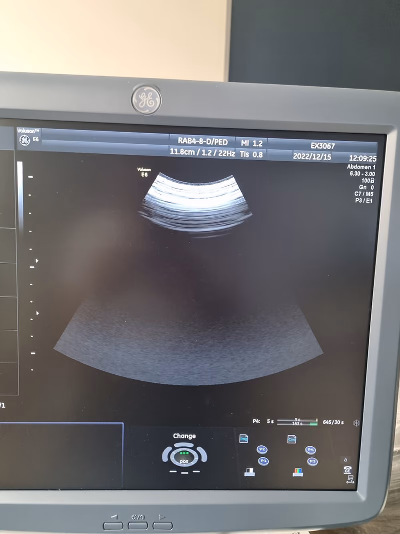 2015 GE Voluson E6 BT 13.5, photo 7