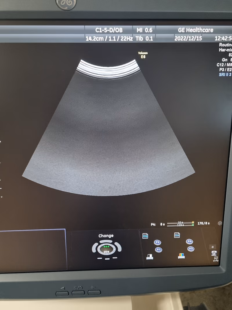 2014 GE Voluson E6 BT13.5, photo 5