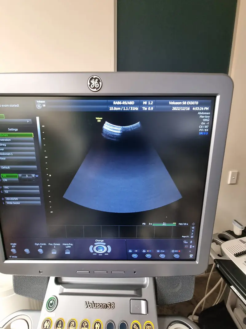 2014 GE Voluson S8, photo 3