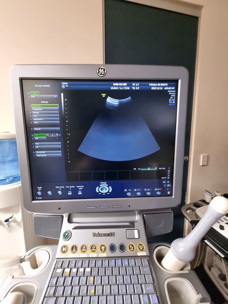 2014 GE Voluson S8, photo 5