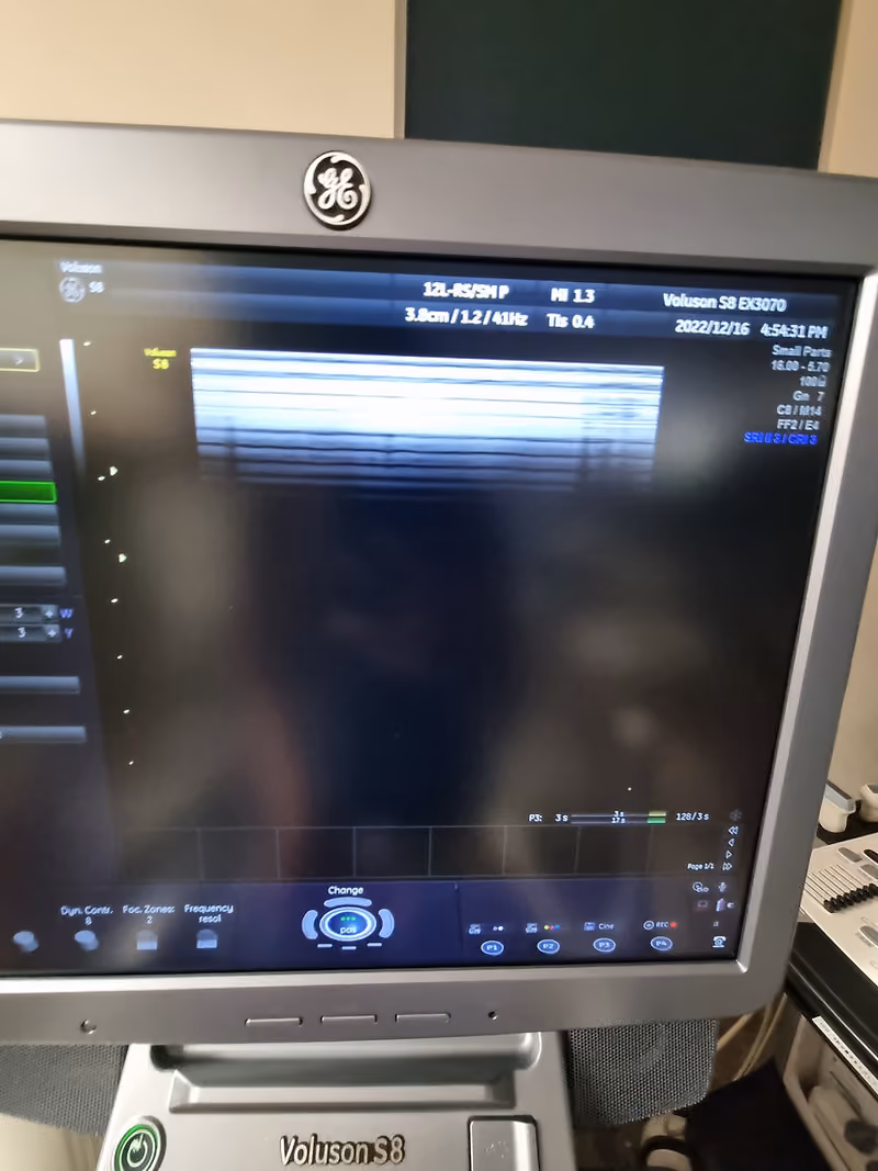 2014 GE Voluson S8, photo 6