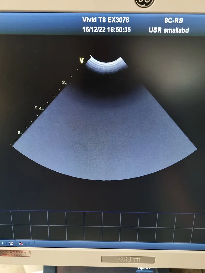 2014 GE Vivid T8, photo 3