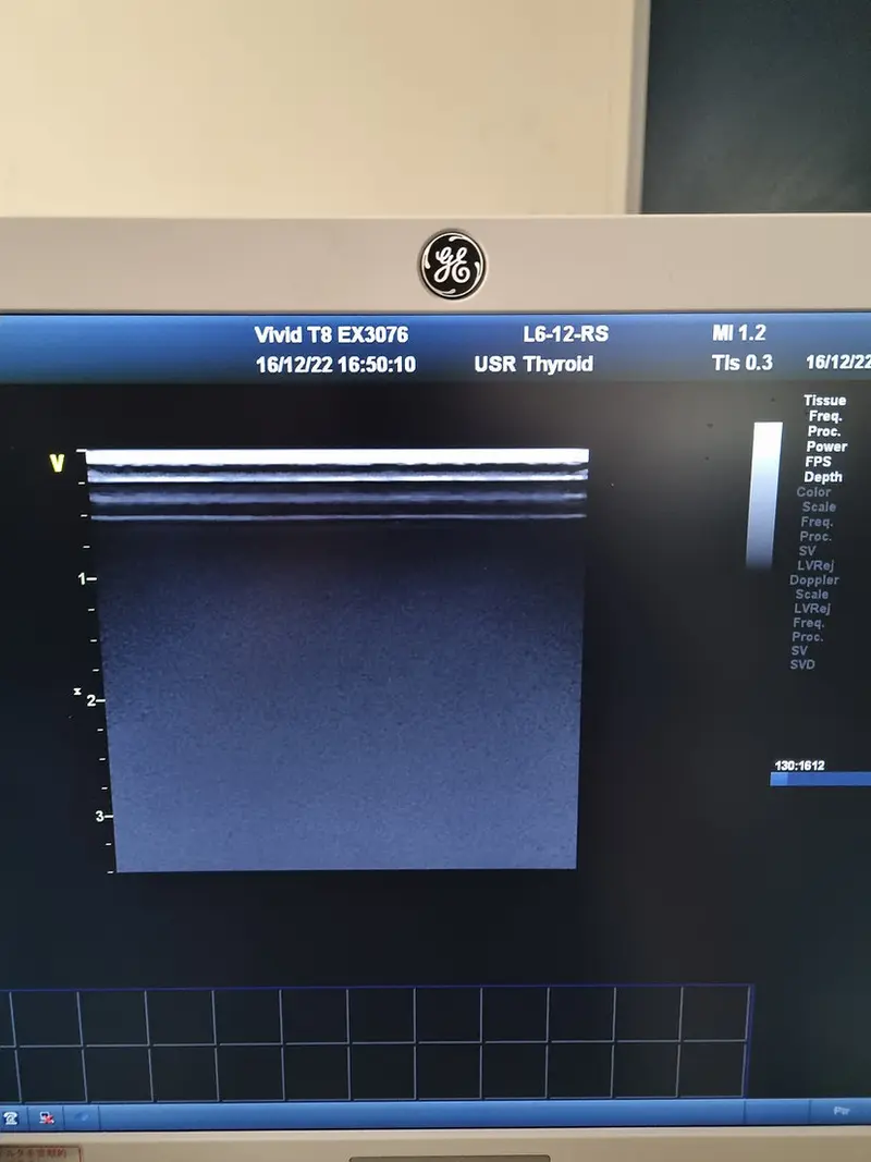 2014 GE Vivid T8, photo 4