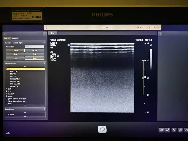 2013 Philips Epiq 7G, photo 3