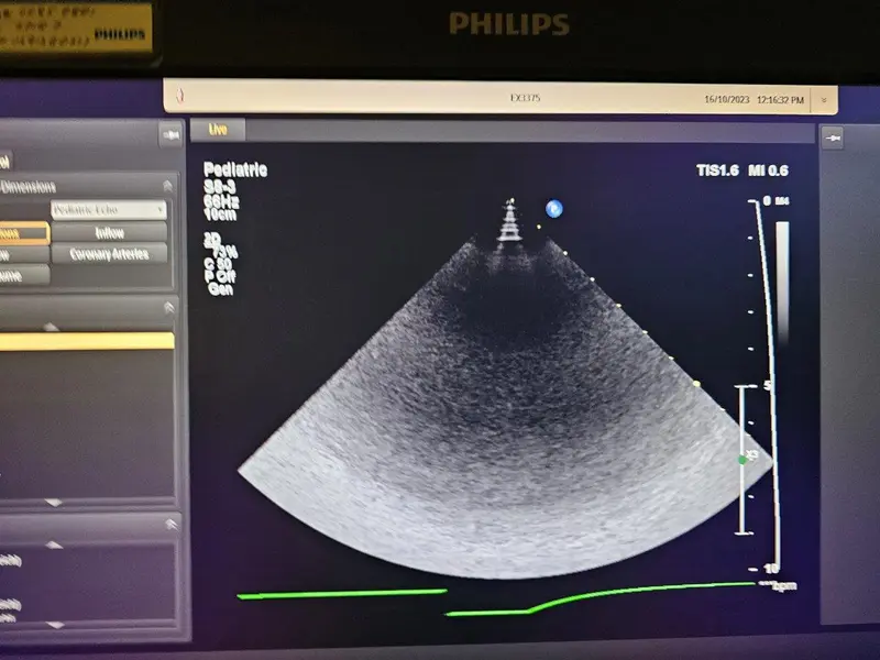 2013 Philips Epiq 7G, photo 4