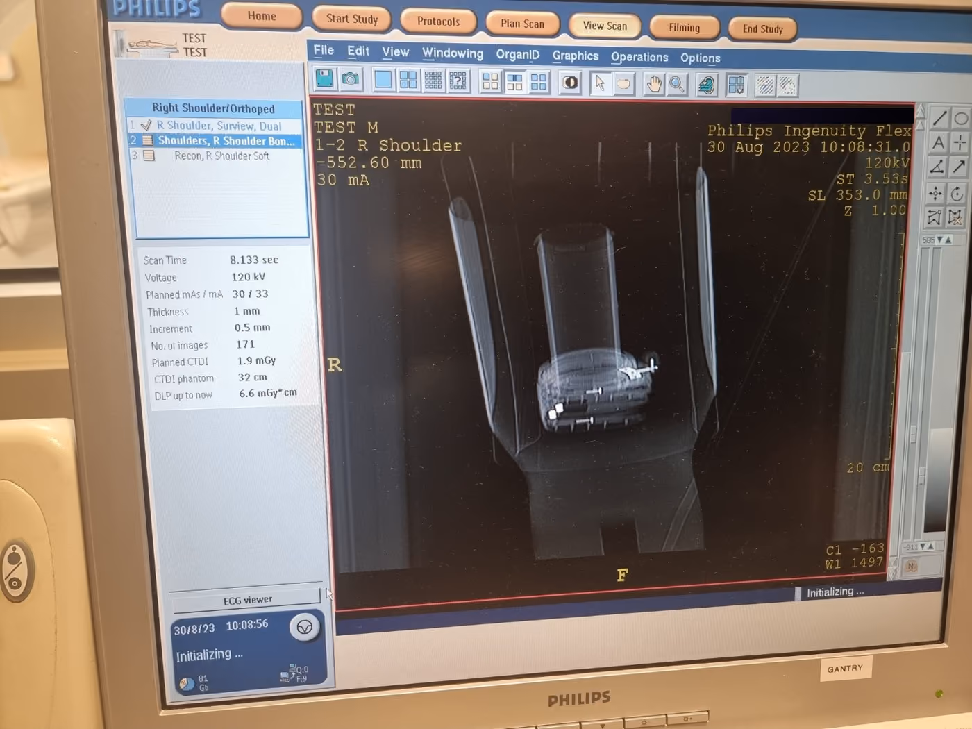 2015 Philips Ingenuity Flex 16 Slice, photo 6