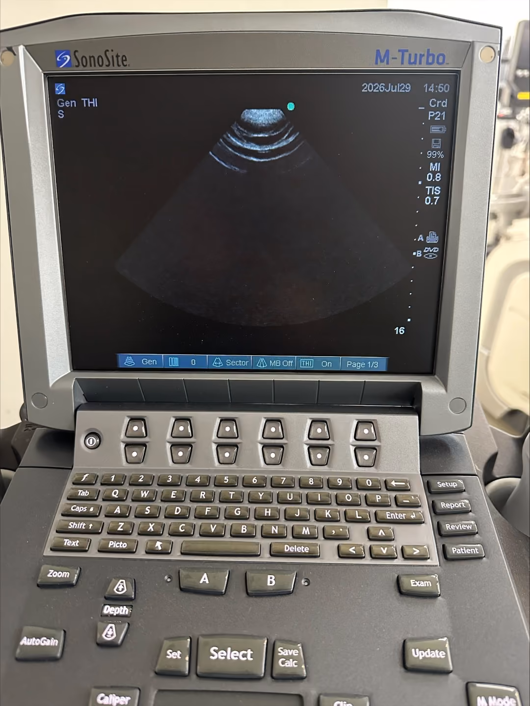 2018 Sonosite Fujifilm SonoSite M-Turbo, photo 6