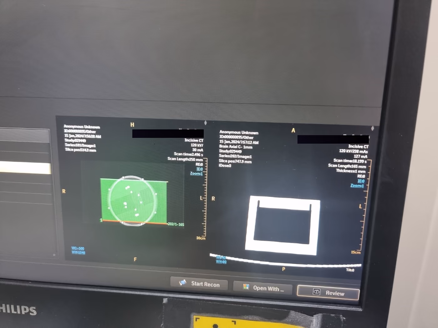 2019 Philips Incisive 128 Slice, photo 7