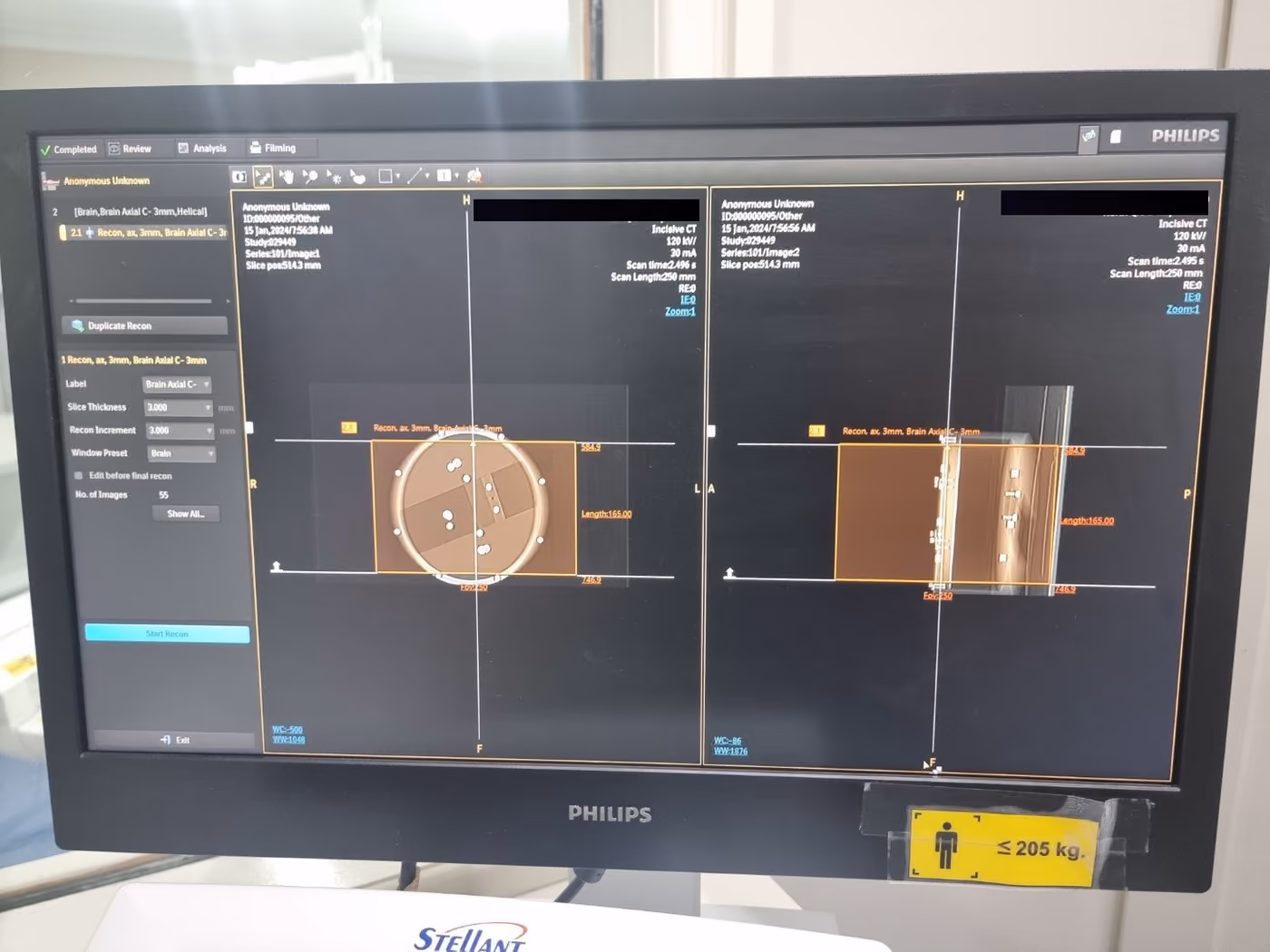 2019 Philips Incisive 128 Slice, photo 8