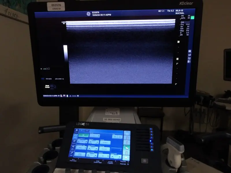 2014 GE Logiq S8 with XD Clear, photo 2